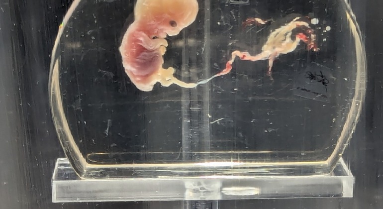 Cara B de México DF Free Tour: Murales, fantasmas y leyendas México &mdash; #3